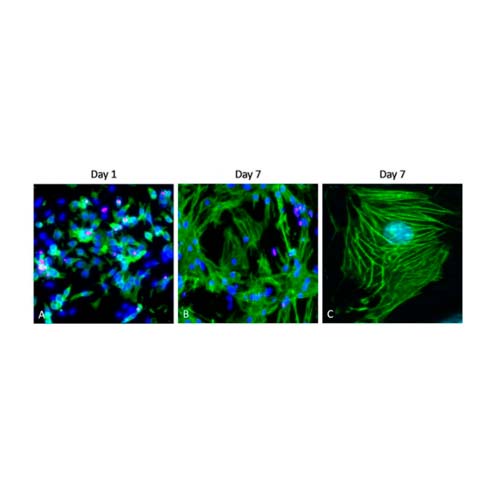 53729. CARDIAC TROPONIN T ANTIBODY (13-11) 200UL - INVITROGEN
