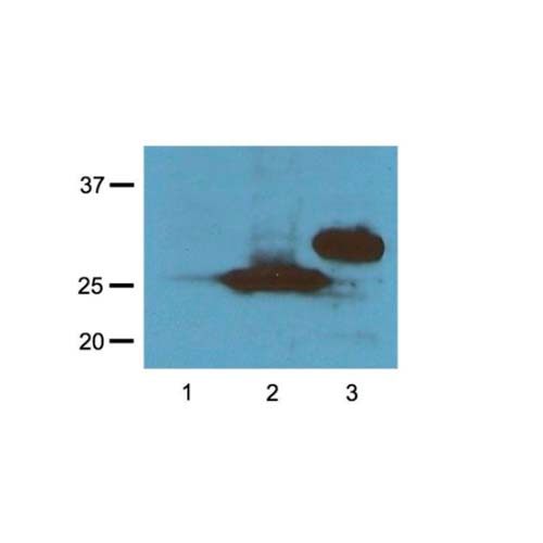 20515. RFP MONOCLONAL ANTIBODY(RF5R) 100UG - INVITROGEN