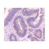 22735. ALIX RECOMBINANT RABBIT MONOCLONAL ANTIBODY (JM85-31) 100UL INVITROGEN
