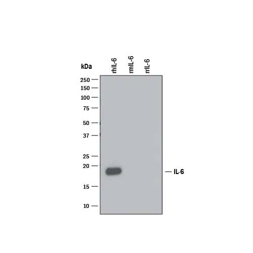 21075. HUMAN/PRIMATE IL-6 ANTIBODY 25UG - R&D SYSTEMS