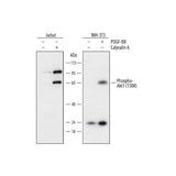 20518. HUMAN PHOSPHO-AKT1 (T308) ANTIBODY 100UG - R&D SYSTEMS