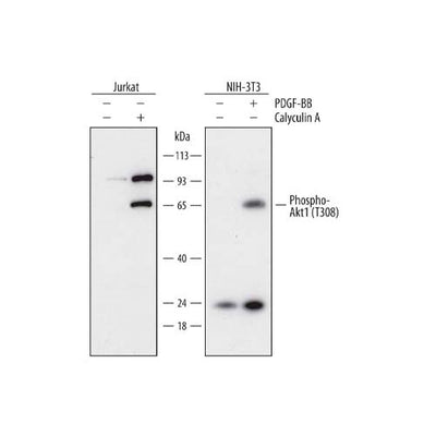 20518. HUMAN PHOSPHO-AKT1 (T308) ANTIBODY 100UG - R&D SYSTEMS