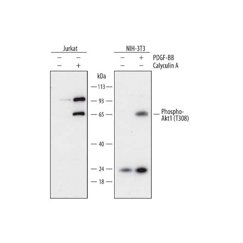20518. HUMAN PHOSPHO-AKT1 (T308) ANTIBODY 100UG - R&D SYSTEMS