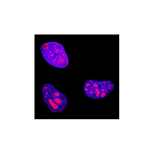 12403. HUMAN KI67/MKI67 ANTIBODY 25UG - R&D SYSTEMS