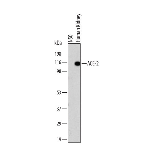 7537. HUMAN/HAMSTER ACE-2 ANTIBODY 500UG - R&D SYSTEMS