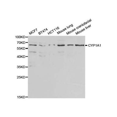 20408. CYP1A1 POLYCLONAL ANTIBODY 0.05ML - MY BIOSOURCE