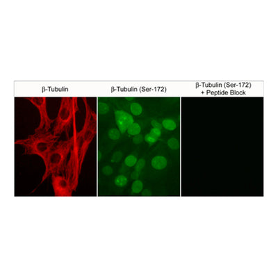 7542. RABBIT BETA-TUBULIN (SER-172) POLYCLONAL ANTIBODY 0.1ML - MY BIOSOURCE