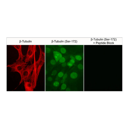 7542. RABBIT BETA-TUBULIN (SER-172) POLYCLONAL ANTIBODY 0.1ML - MY BIOSOURCE