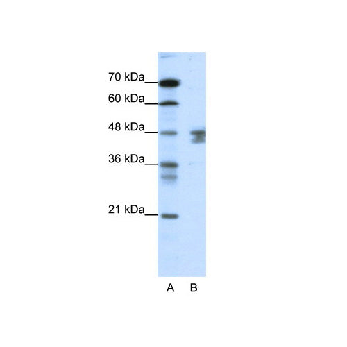 4449. EPSTEIN-BARR VIRUS EBNA1 RECOMBINANT PROTEIN 1MG - MYBIOSOURCE