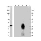 15800. CALRETININ (CALB2) MONOCLONAL ANTIBODY 0.1ML - MY BIOSOURCE