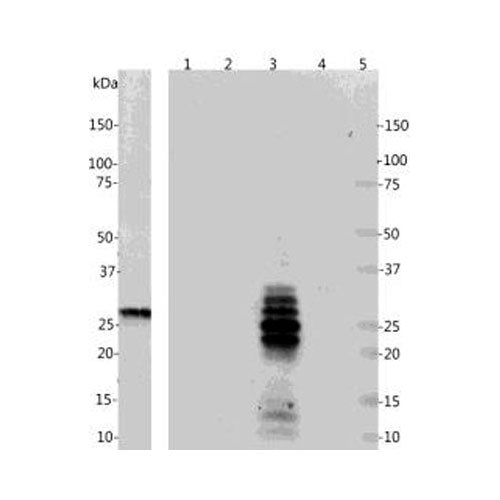15800. CALRETININ (CALB2) MONOCLONAL ANTIBODY 0.1ML - MY BIOSOURCE
