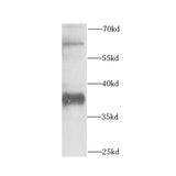 7543. RABBIT CNPY3 POLYCLONAL ANTIBODY 0.1MG - MY BIOSOURCE