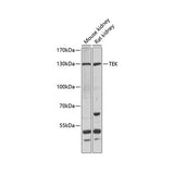 7544. ANTI-TEK ANTIBODY RABBIT TEK POLYCLONAL ANTIBODY 0.05ML - MY BIOSOURCE