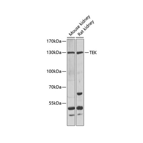 7544. ANTI-TEK ANTIBODY RABBIT TEK POLYCLONAL ANTIBODY 0.05ML - MY BIOSOURCE
