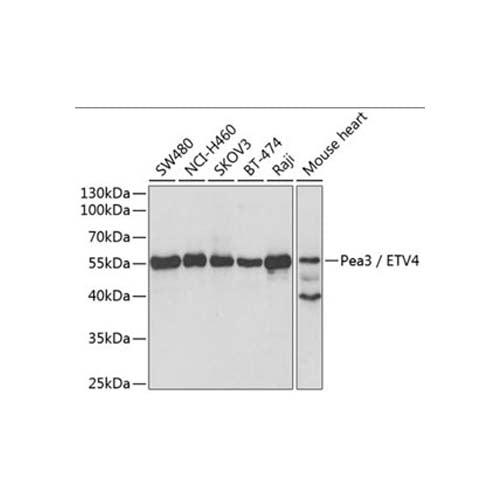 21044. RABBIT ETV4 POLYCLONAL ANTIBODY 0.1ML MY - BIOSOURCE