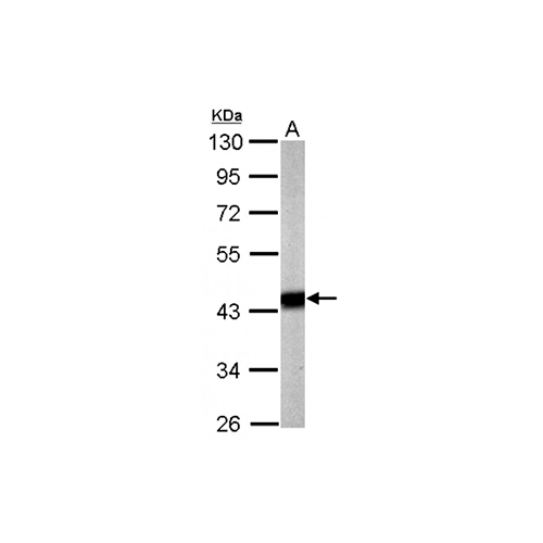 5707. ANTI-PDHA1 ANTIBODY RABBIT PDHA1 POLYCLONAL ANTIBODY 0.1ML - MY BIOSOURCE