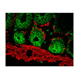 21114. M.O.M. (MOUSE ON MOUSE) BLOCKING REAGENT 1ML - VECTOR