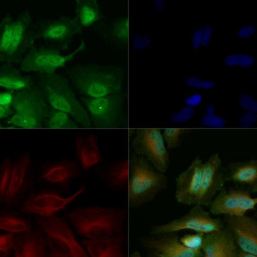 4450. GLUT4 ANTIBODY 0.1ML - NOVUS