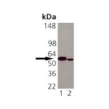 21698. MOUSE MONOCLONAL CALRETICULIN ANTIBODY (FMC 75) 0.2MG - NOVUS BIOLOGICALS
