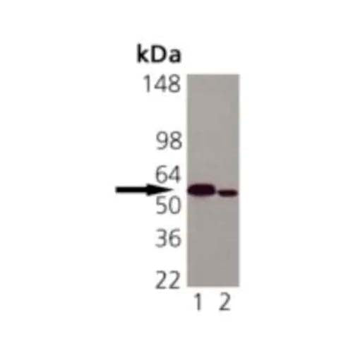 21698. MOUSE MONOCLONAL CALRETICULIN ANTIBODY (FMC 75) 0.2MG - NOVUS BIOLOGICALS