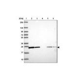 21699. RABBIT POLYCLONAL RAB1A ANTIBODY 0.1ML - NOVUS BIOLOGICALS
