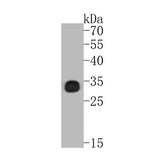4948. BCL-XL ANTIBODY (SZ3-03) 100UL - NOVUS BIOLOGICALS