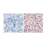 21864. ANDROGEN RECEPTOR POLYCLONAL ANTIBODY 200UL - INVITROGEN