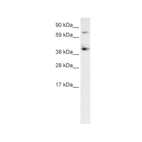 4885. SP7 RABBIT-ANTIHUMAN POLYCLONAL ANTIBODY 50UG - INVITROGEN