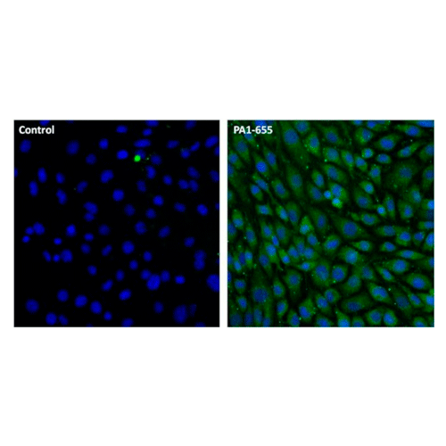 26906. LAMP2 POLYCLONAL ANTIBODY 100UL INVITROGEN