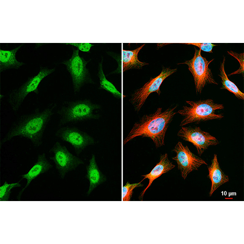 22474. OGT POLYCLONAL ANTIBODY 100UL INVITROGEN