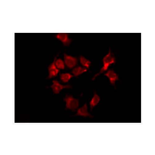 21870. PHOSPHO-TSC2 (THR1462) POLYCLONAL ANTIBODY 100UL - INVITROGEN