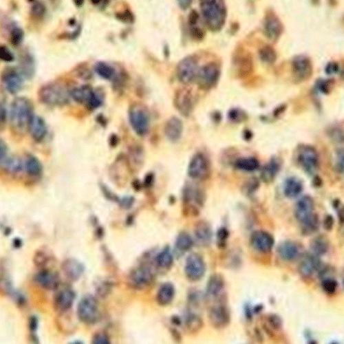 26902. KIAA0090 POLYCLONAL ANTIBODY 400UL INVITROGEN