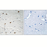 22468. PHOSPHO-AKT PAN (TYR315, TYR316, TYR312) POLYCLONAL ANTIBODY 100UG INVITROGEN