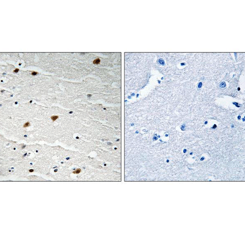 22468. PHOSPHO-AKT PAN (TYR315, TYR316, TYR312) POLYCLONAL ANTIBODY 100UG INVITROGEN
