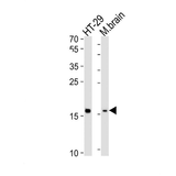 22467. TMEM160 POLYCLONAL ANTIBODY 400UL INVITROGEN