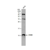 53489. RABBIT ANTI-HUMAN, MOUSE, RAT S100B P. ANTIBODY 100UL - INVITROGEN