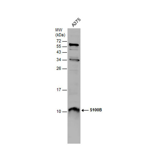 53489. RABBIT ANTI-HUMAN, MOUSE, RAT S100B P. ANTIBODY 100UL - INVITROGEN