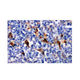 21875. CD68 POLYCLONAL ANTIBODY 100UG - INVITROGEN