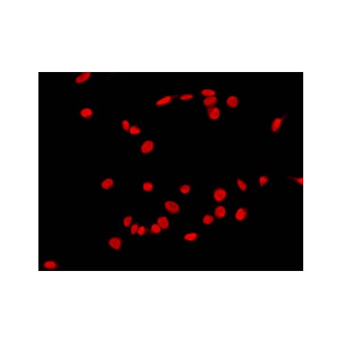 21879. C-FOS POLYCLONAL ANTIBODY 100UL - INVITROGEN
