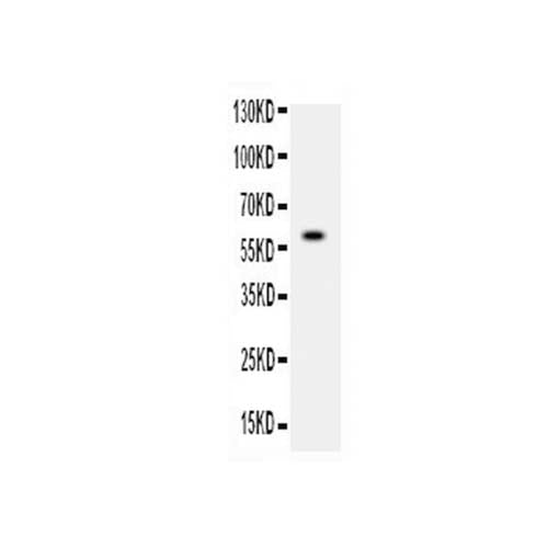 20944. ADAMTS4 POLYCLONAL ANTIBODY 100UG - INVITROGEN