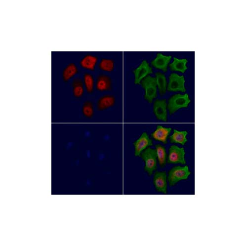 21869. PHOSPHO-P21 (THR145) POLYCLONAL ANTIBODY 100UL - INVITROGEN