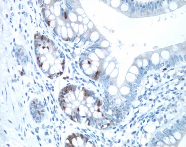 6470. VECTASTAIN ELITE ABC-HRP KIT PEROXIDASE (RABBIT IGG) - VECTOR