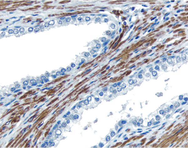 6469. VECTASTAIN UNIVERSAL QUICK HRP KIT PEROXIDASE (CONCENTRATE) - VECTOR