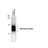 26591. GABA-A R BETA 2 C-TERMINUS ANTIBODY 100UL R&D SYSTEMS
