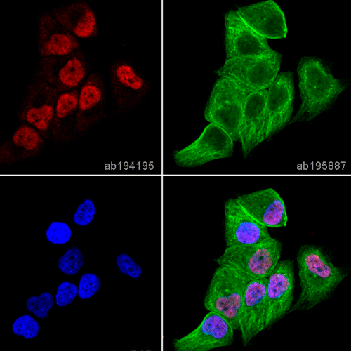 26456. RECOMBINANT ALEXA FLUOR647ANTI-ANDROGEN RECEPTOR (EPR1535(2)) 100UL ABCAM