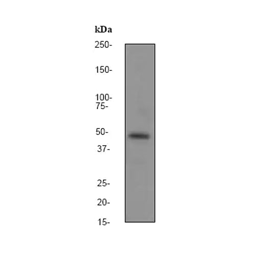 4635. RECOMBINANT ANTI-GSK3 (ALPHA + BETA) ANTIBODY (EP933Y) 100UL - ABCAM