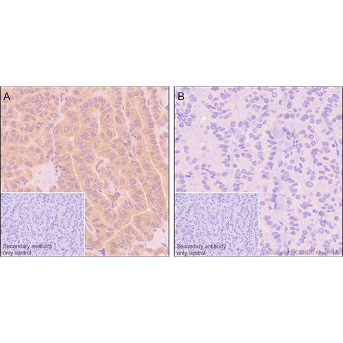 4654. RECOMBINANT ANTI-GSK3 (ALPHA + BETA) (PHOSPHO Y216 + Y279) ANTIBODY (EPR933Y) 100UL - ABCAM